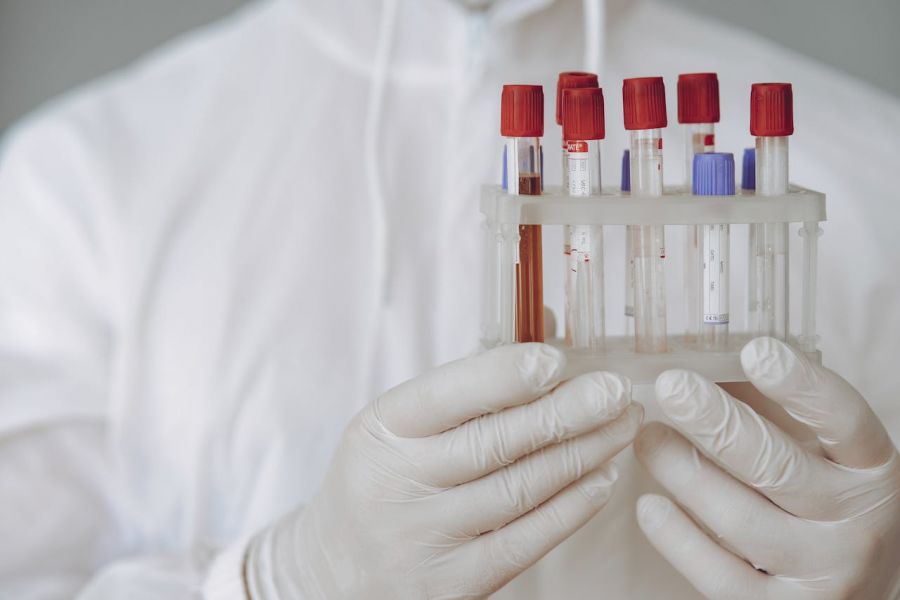 Analize pentru monitorizarea functiei hepatice si renale